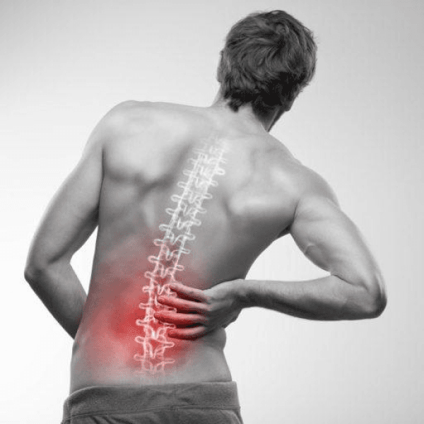 Low Back Pain